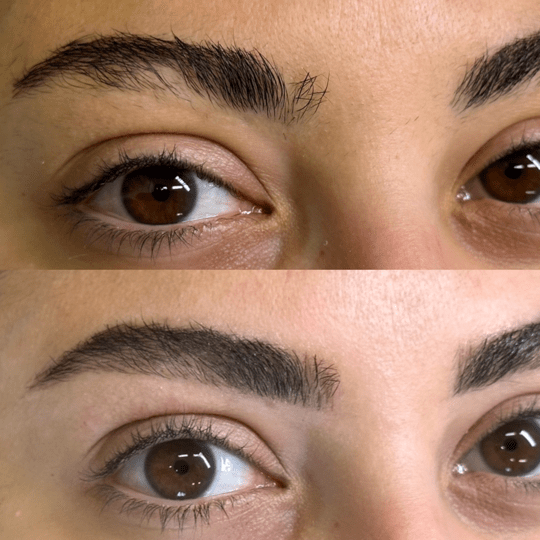 ANTES-E-DEPOIS-NANO-00010-min.png