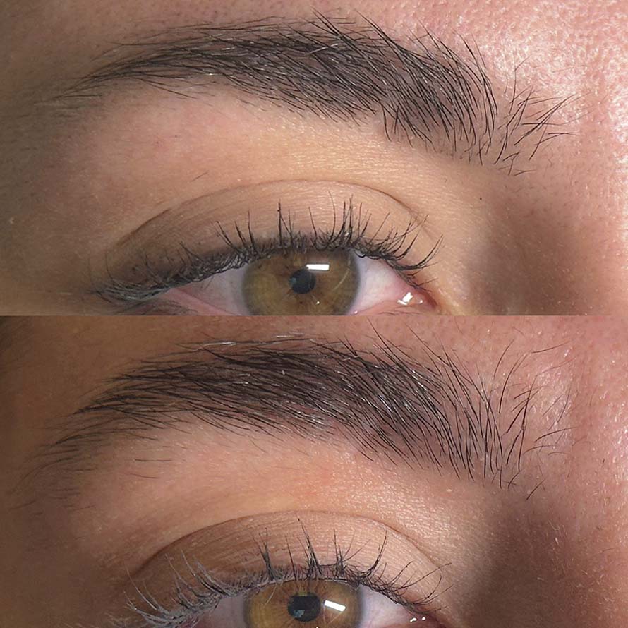 Antes e depois microagulhamento - Evolved Hair - Brows by Moura - Copia