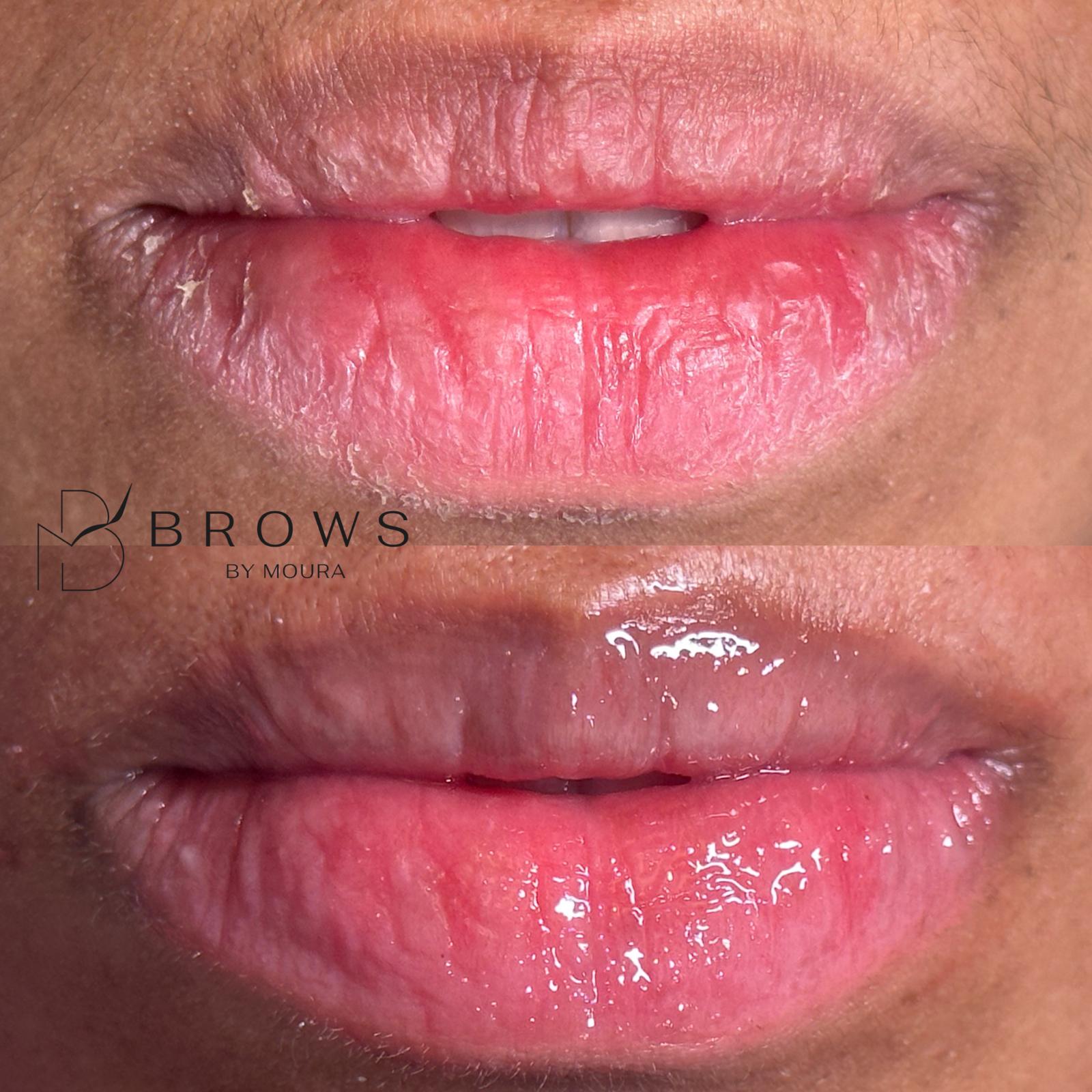 Revita Lips - Brows by Moura