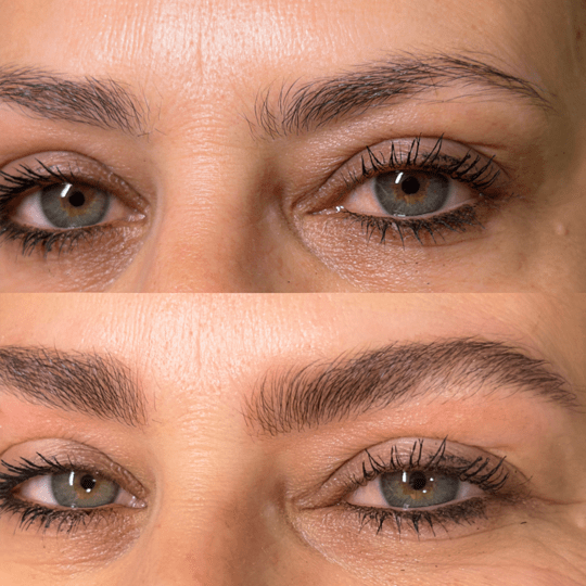 antes-e-depois-Nanoblading-001-min.png