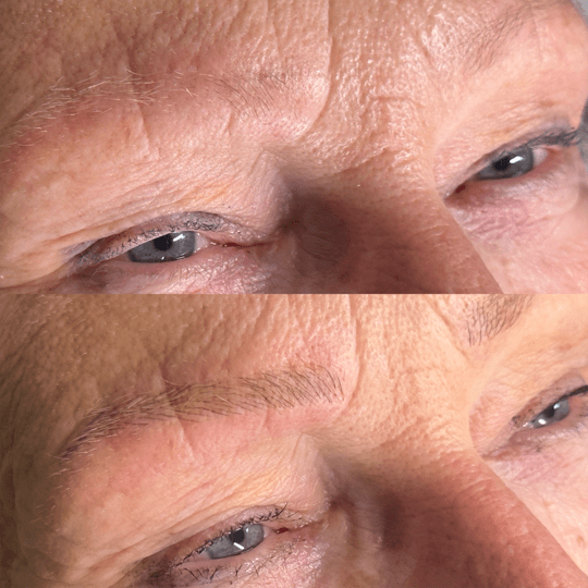 antes-e-depois-Nanoblading-002-min.png