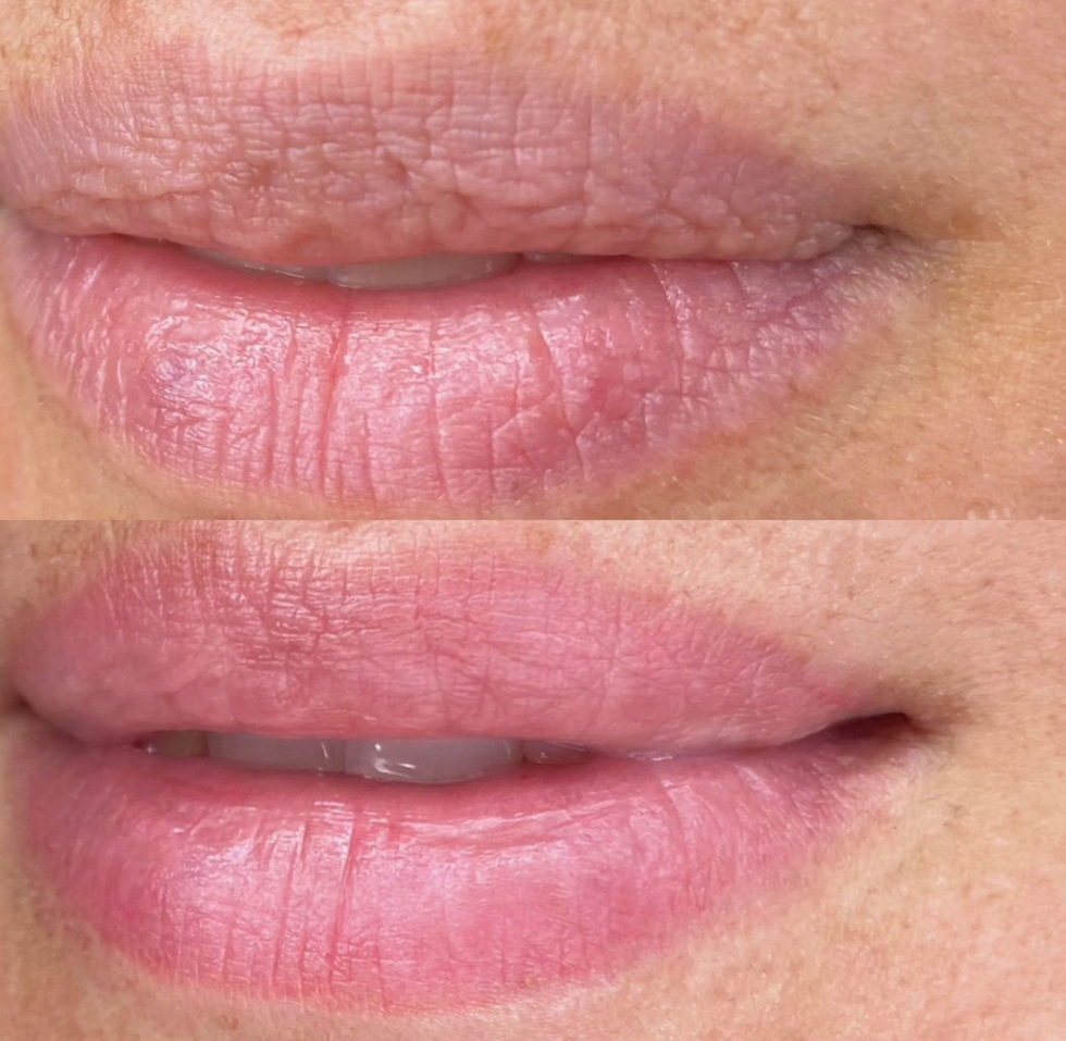 Before-After-Blush-Lips (1)