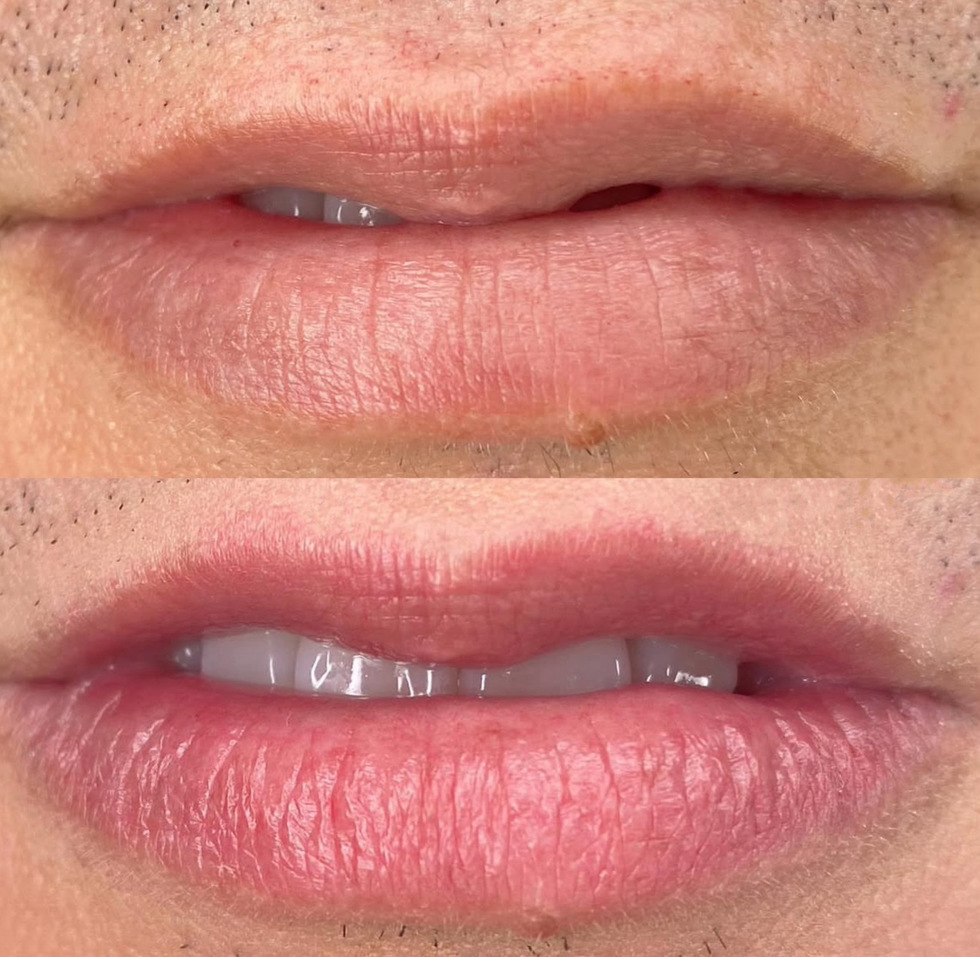 Before-After-Blush-Lips (2)