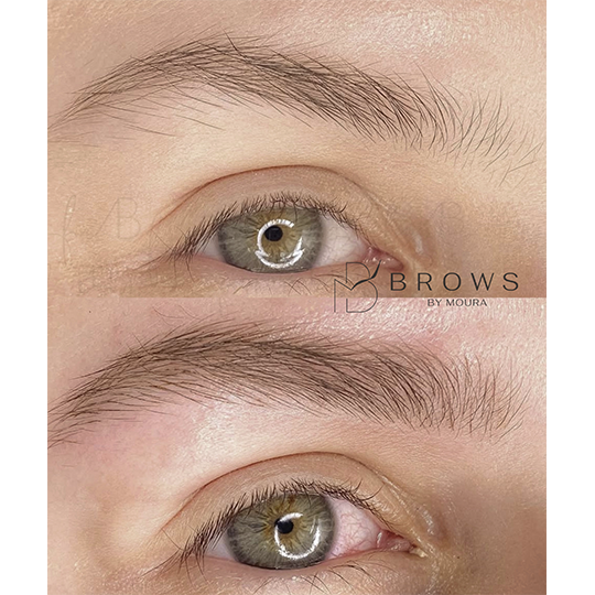 antes-e-depois-Nanoblading-0011-min