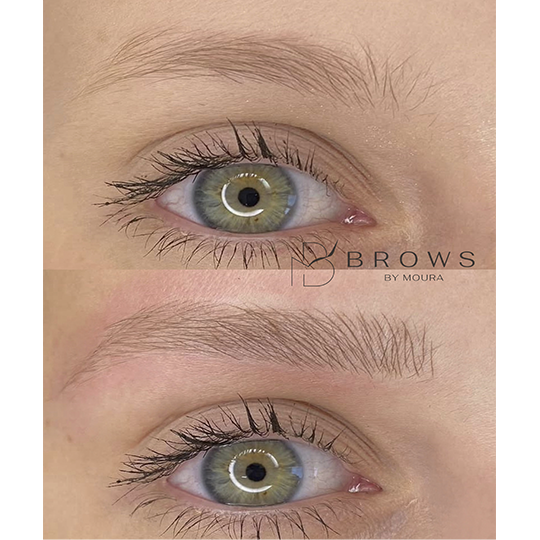 antes-e-depois-Nanoblading-0012-min