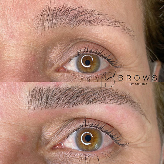 antes-e-depois-Nanoblading-0014-min