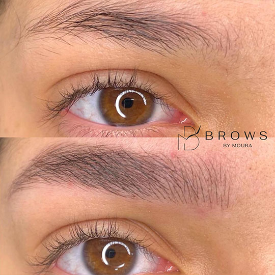 antes-e-depois-Nanoblading-0015-min