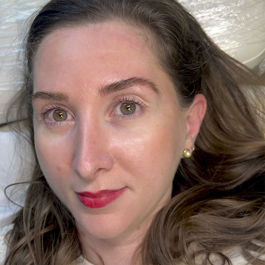 antes-e-depois-Nanoblading-0016-min